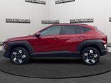 2024 Hyundai Kona 2.0L Preferred image 2