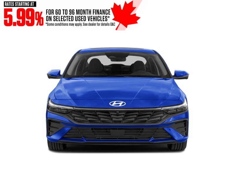 2026 Hyundai Elantra Luxury IVT Exterior Shot 5